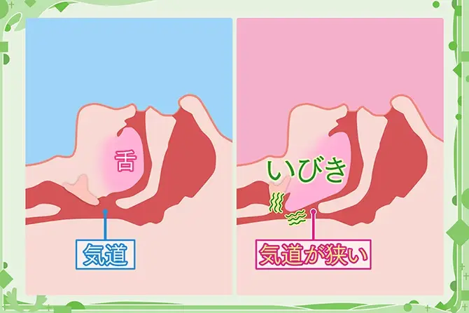 いびきをかく原因とは
